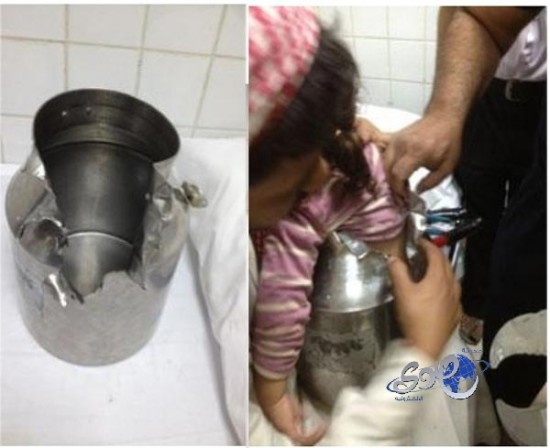 “مدني” تربة ينقذ طفلة علقت في إناء حليب