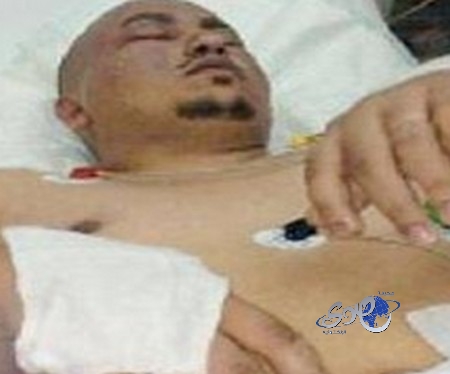 علامة واحدة في جسدك قد تكشف نقص فيتامين خطير