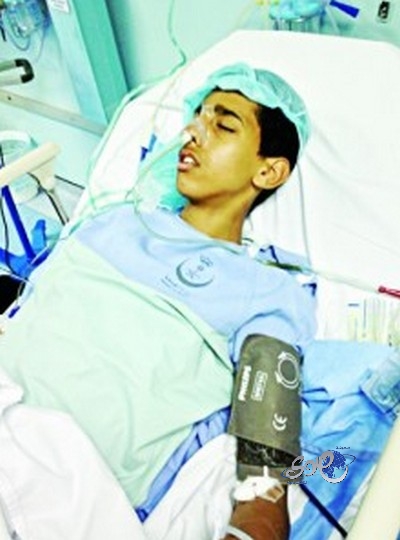 إهمال طبي يؤدي إلى انفجار الزائدة الدودية لشاب في الباحة