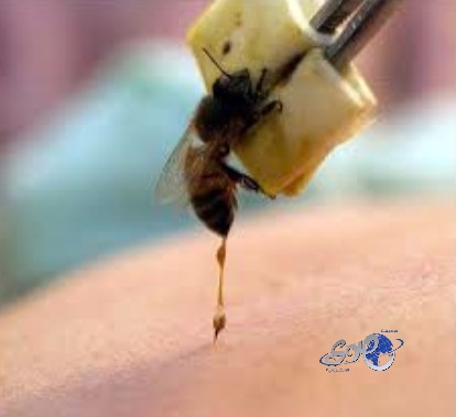 دراسة علمية حديثة: وخز النحل يحمي من الإصابة بالإيدز