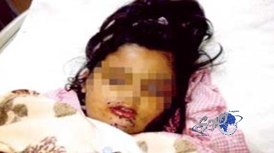 ضحية جديدة للإهمال و”صحة تبوك” تعد بالتحقيق