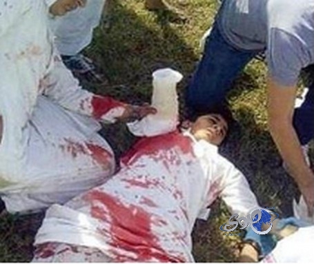 شاب سعودي ينقذ «طفلا» سوريا من الموت