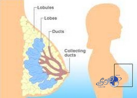 مجموعة من الجينات يمكن أن تساعد في تحديد الإصابة بسرطان الثدي