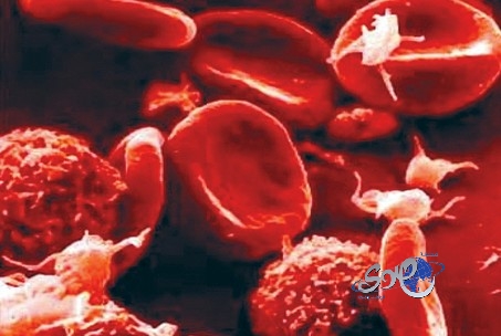 علاج ناجع لسرطان الدم الليمفاوي