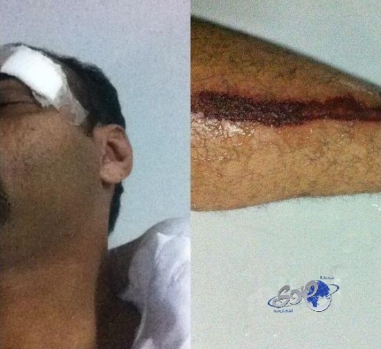 شاب يتسبب في إصابة رجل أمن ويلحق أضراراً بدورية أمن طرق