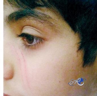 إداري يعتدي على طالب ويعضّه.. وشرطة ثادق تتسلم تقريراً من المستشفى