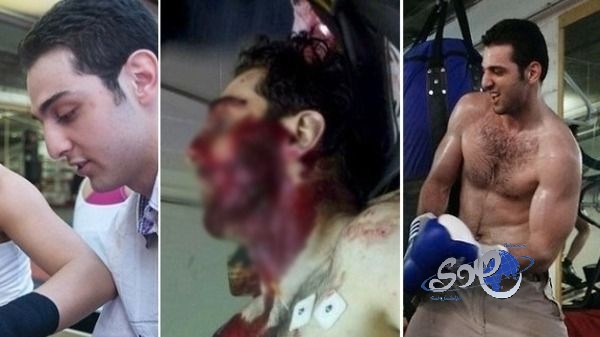 أول صورة دموية لمنفذ تفجير بوسطن وهو قتيل