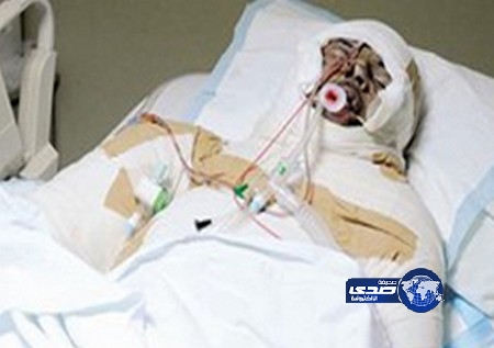 سوري يحرق نفسه في لبنان بسبب ضائقة مادية