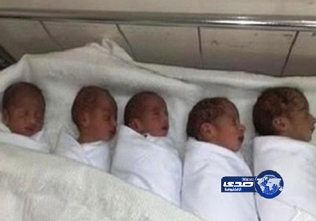 عشرينية تضع خمسة توائم