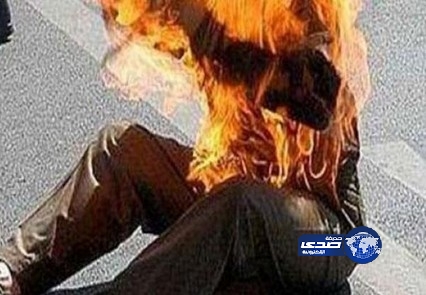 شاب يحرق جسده بعد أن تخلت عنه حبيبته