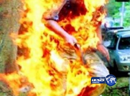 يحرق نفسه بعد تخلي زوجته عنه