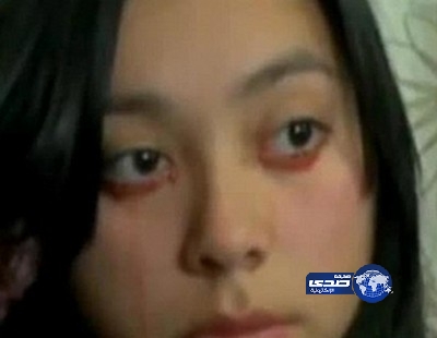 بالفيديو .. تشيلية تبكي دماً بدل الدموع