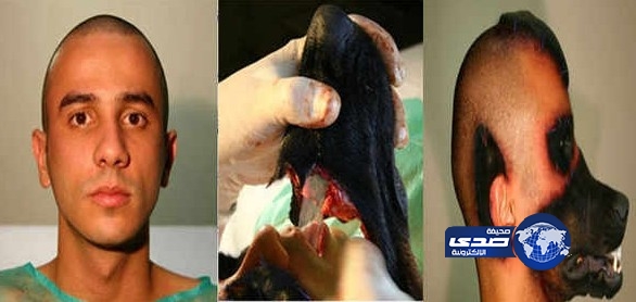 بالفيديو .. شاهد شاب برازيلى يتحول إلى كلب