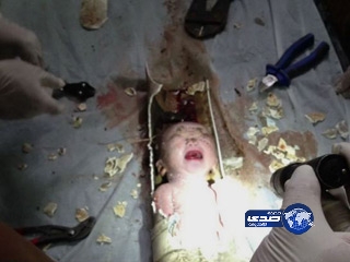 إنقاذ مولود جديد ألقته والدته في مجارير مبنى