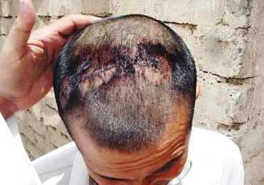 امرأة تضرب زوجها بـ”الساطور” 10 مرات بعد أن هددها بـ”الطلاق”