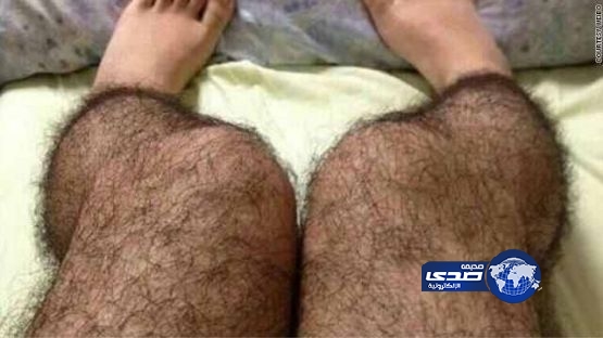 جوارب صينية مشعّرة تمنع الاغتصاب