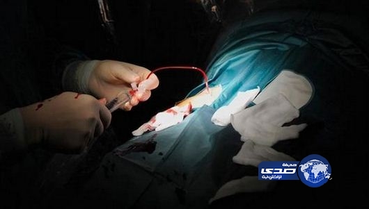 إجراء عملية جراحية على ضوء الجوال بعد انقطاع التيار الكهربائي