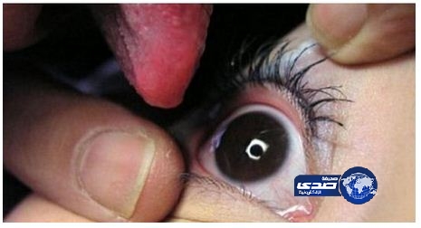 لعق “العيون”أغرب وسيلة للتعبير عن الحب