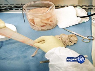 توقيف زعيم عصابة دولية للاتجار بالأعضاء البشرية