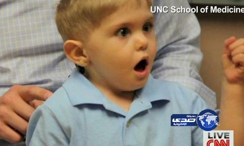 الطب يحقق “نجاح جديد” ويعيد السمع لطفل .. والدهشة تظهر على وجهه