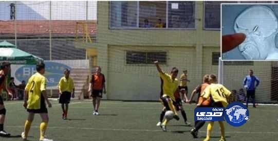 يلعب مباراة كاملة وبرأسه رصاصة