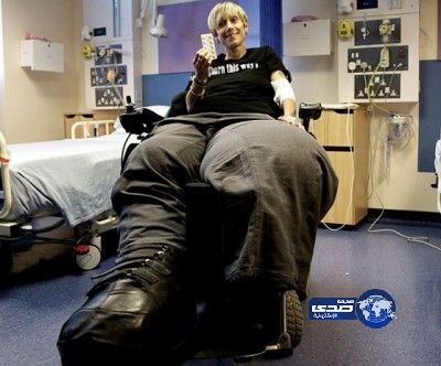 بالصور … امرأة تعـاني من عــدم توقـف نمو قـدميـها