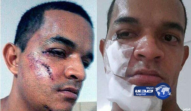 “فيديو” أعنف تدخل في تاريخ كرة القدم