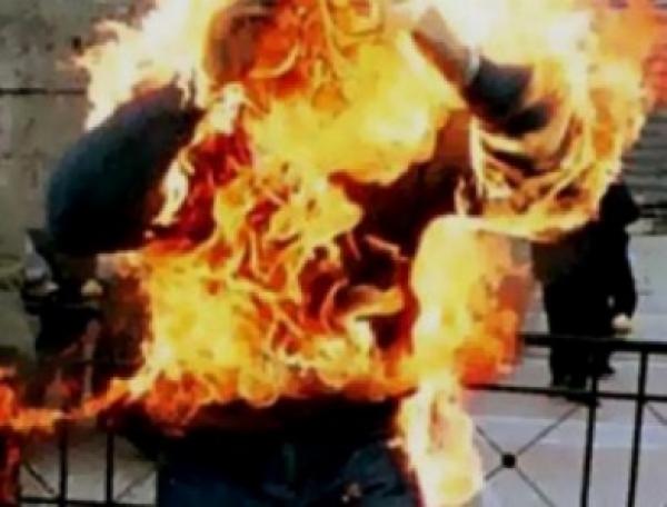 يضرم النار في نفسه بسبب.. الكحول