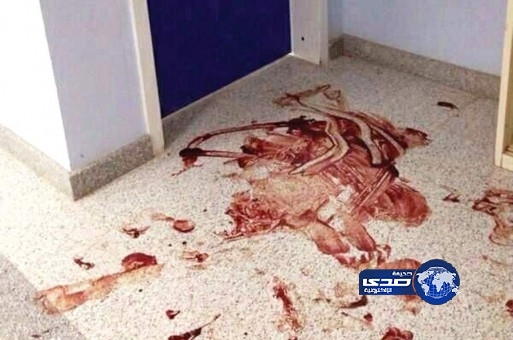 سبع إصابات في عراك ناري بمستشفى “يدمة”