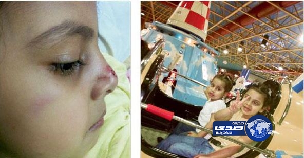 والد تالا.. غياب حزام الأمان وراء إصابة ابنتي في المدينة الترفيهية