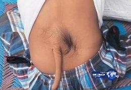 صبي يتحول إلى إله عند الهندوس في الهند بسبب “ذيله”