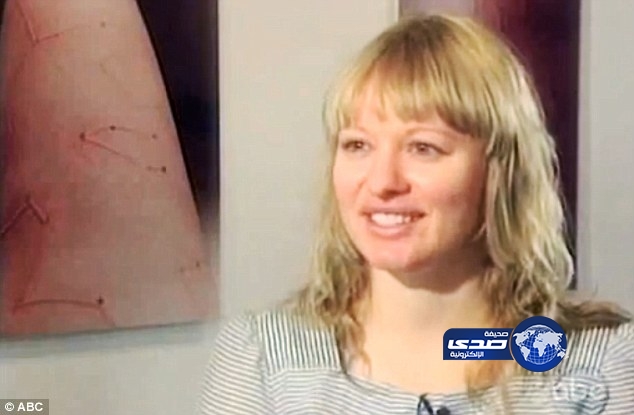 بالصور..أمريكية تستغل مرضها النادر لرسم لوحات فنية على جلدها