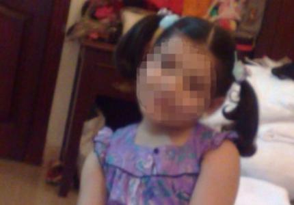 ينتقم من عشيقته بتشويه وجه ابنتها