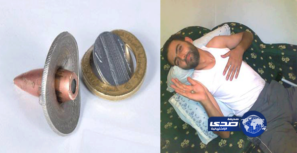 عملات معدنية تنقذ شابا سوريا من الموت