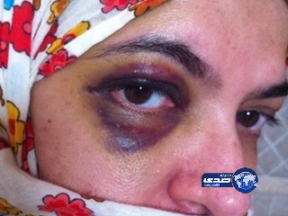 مواطن يعتدي على أخته بالضرب المبرح في الشارع