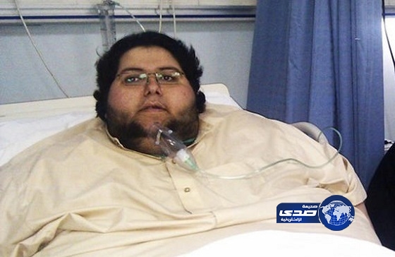 مصدر طبي : سبب وفاة مريض السمنة الدوسري أزمة حادة بالتنفس