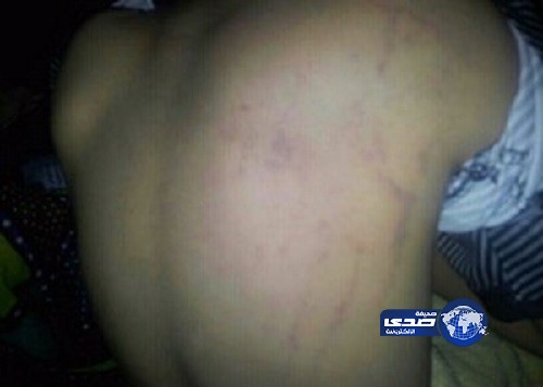 “تعليم صبيا” تحقّق في اعتداء مُعلِّم على طالب ابتدائية بضمد