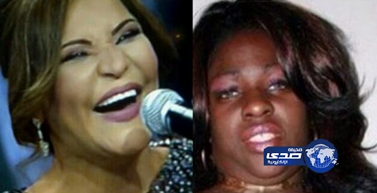 زبيدة بخيت ساخرة ..خشم احلام داق اشاره يسار ؟