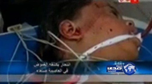 بالفيديو.. يمني يرمي طفلتيه من الطابق الخامس ثم ينتحر