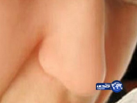 أنف صناعية قادرة على الكشف عن رائحة الجراثيم فى الدم لمنع تعفنه