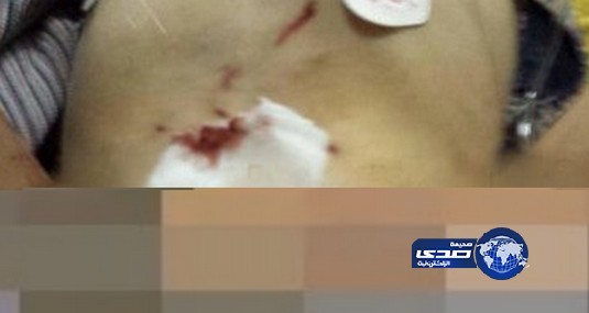 الحكومة الاردنية تهدد أسرة بمعاقبتها بعد ازالة اعضاء ابنهم التناسلية