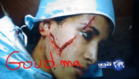 زوج يمزق وجه زوجته بالسكين ويحاول حرقها