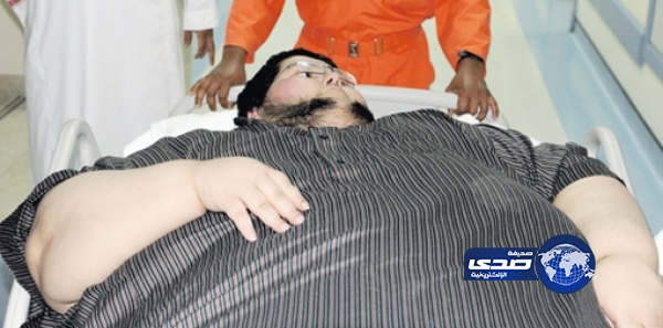 وفاة مريض السمنة “ماجد” صباح اليوم في “البرج الطبي”