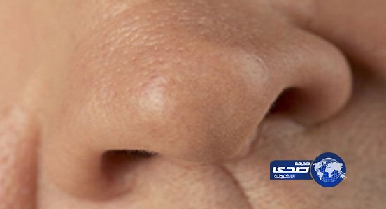 بريطاني ينسى أنفه في عيادة الأسنان!