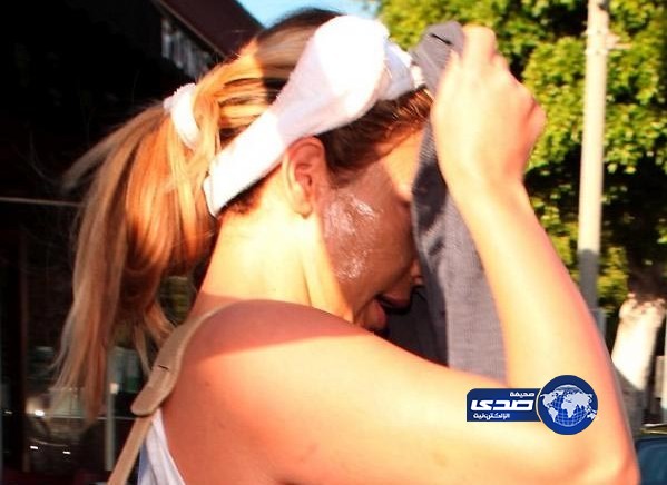 آثار غريبة تظهر على وجه كيم كارداشيان !