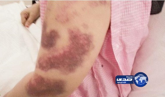 الدفاع المدني والشرطة ينقذان معنفة من رشاش ومسدس الزوج