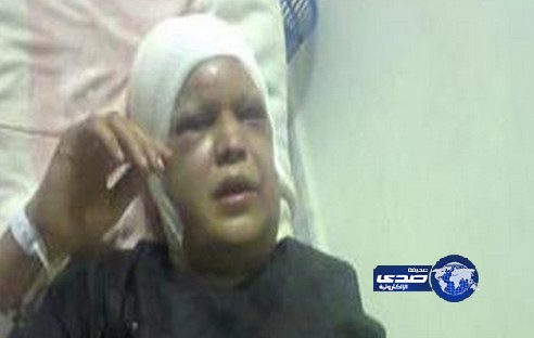 يقضي جلسة سكر مع زوجته ثم يقطع أذنيها