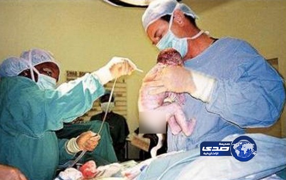 أطباء فصلوا رأس الجنين أثناء ولادته.. وفروا هاربين!!