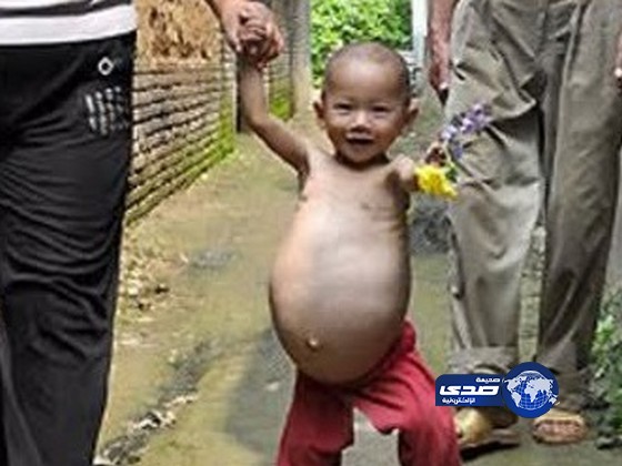 اكتشاف حمل طفلة صينية عمرها سنة واحدة