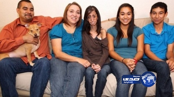 20 دقيقة أكل تبقى أنحف إمراة في العالم على قيد الحياة